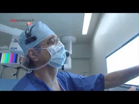 Vidéo: Hernie De L'ouverture œsophagienne Du Diaphragme - Symptômes, Traitement, Chirurgie