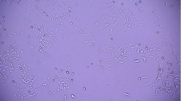 24h Live Cell imaging with my self-built live cell imaging microscope