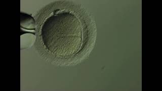 TFP Wessex Fertility - ICSI sperm injection procedure video