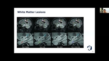 Statistical and AI Methods for Health Data Science Seminar -- Data Harmonization