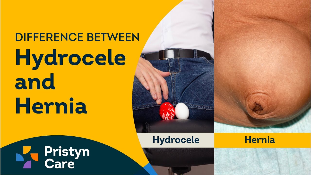 Difference between Hydrocele and Hernia | For Free Consultation Call Now - 08065105034