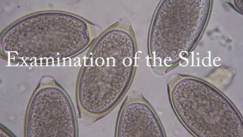 Tutorial McMaster egg counting method