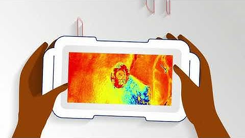 SnapshotNIR in Reconstructive Surgery - Explainer Video