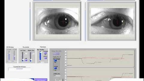 Eye Video Saccade Horizontal.wmv