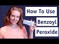 How to use benzoyl peroxide 25 gel for perfect skin 