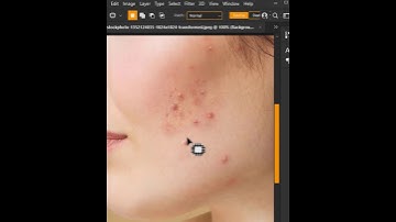 Quick Remove Blemishes and pimples in Photoshop #shorts #photoshop