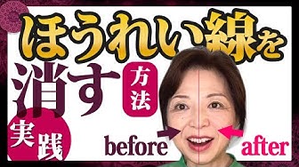 眼瞼下垂マッサージ Youtube