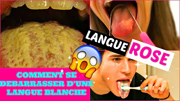 Comment nettoyer sa langue avec une cuillère ?