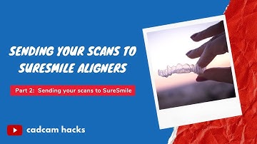 Sending your digital scans to SureSmile Aligners (Part 2 of 3)