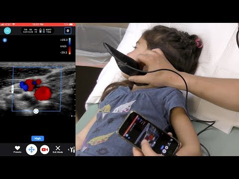 Video: Butterfly IQ: Een IPhone-echografie Heeft Het Leven Van Deze Dokter Gered