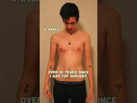 Trans surgery changed my life