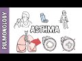 Understanding asthma  pathophysiology and treatment