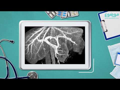 أخطار تضخم الكبد