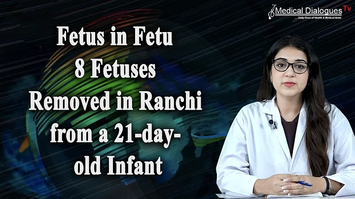 Fetus in Fetu - 8 Fetuses removed in Ranchi from a 21-day-old infant