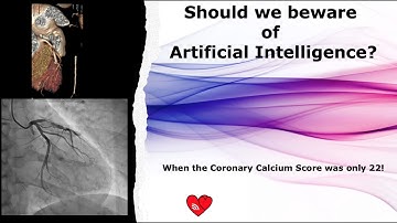 Should we beware of Artificial Intelligence When the coronary calcium score was only 22!