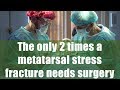 The only 2 times a metatarsal stress fracture needs surgery