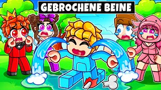 Thumbnail for Ukri hat sein Bein GEBROCHEN in Roblox Snapchat!