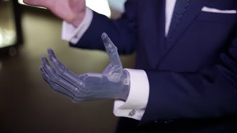 Bertolt Meyer shows us his bionic arm