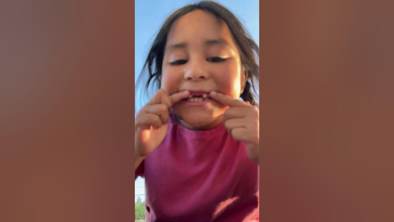 my-tooth-fell-out-at-school-it-hurts-so-bad-and-then-when-i-ate-when-i