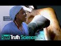 Surgery school episode 3  medical documentary  reel truth science