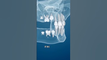 A medicine that re-grows teeth! 😱#sciencefacts #medicine #teeth #tooth #dentist #sciencenews