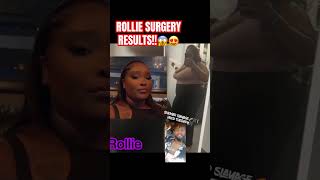 OMG, Rollies RESULTS!!😍🔥#confidence#selflove#surgery#safehaven#rollie#baddieswest#hoodtherapy#fyp