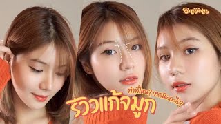 Review แก้จมูก!! ทำที่ไหน ,เทคนิคอะไร ? | BAIIFERN