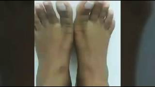 Slim And Thick Feet Beauty Divine