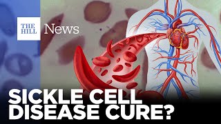 Sickle Cell Gene Therapy: FDA Likely Set to Approve