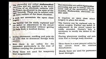 PACEMAKER || S6 || KTU || B TECH ||BIOMEDICAL INSTRUMENTATION