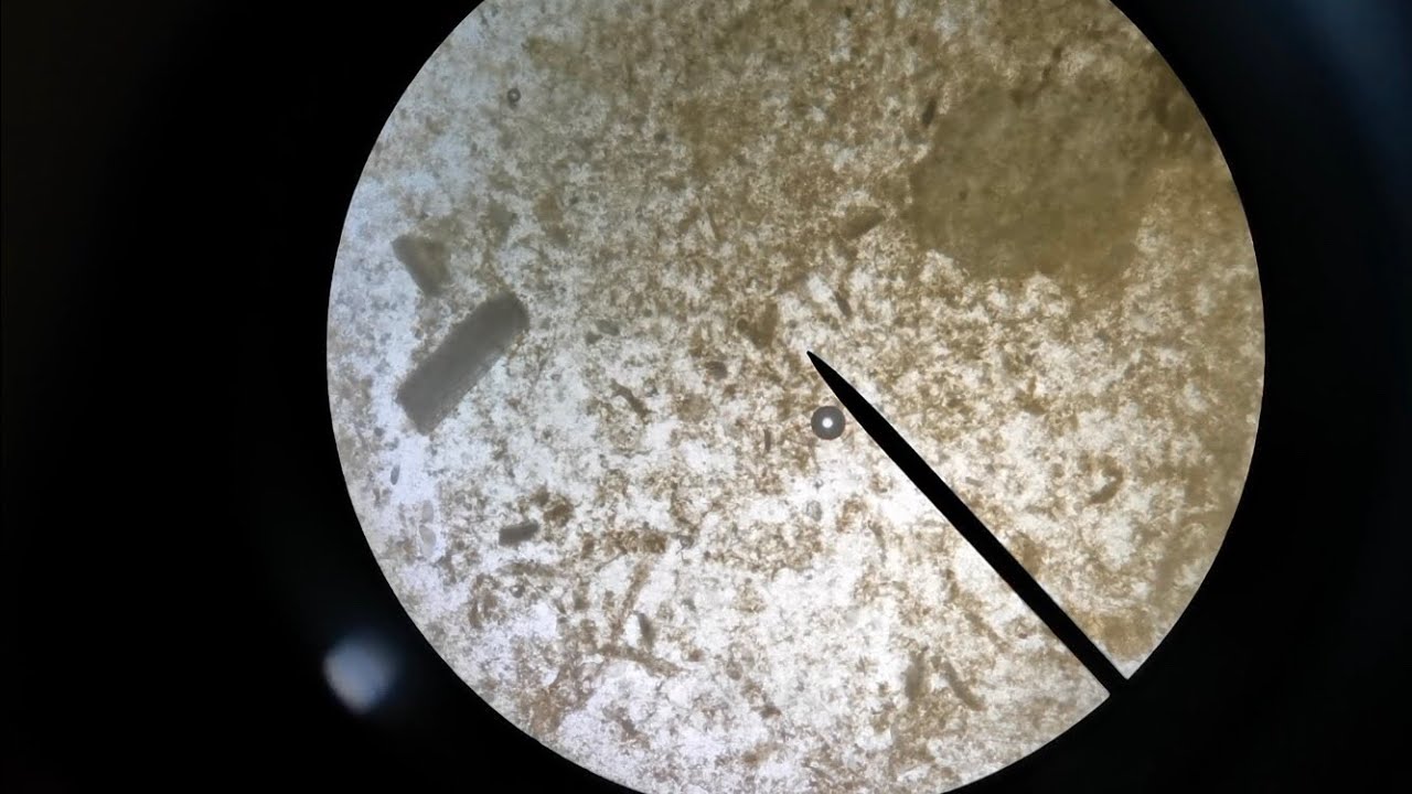 Giardia in Tortoise- Veterinary Case