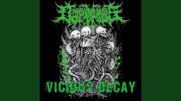 Pathological Apotemnophilia