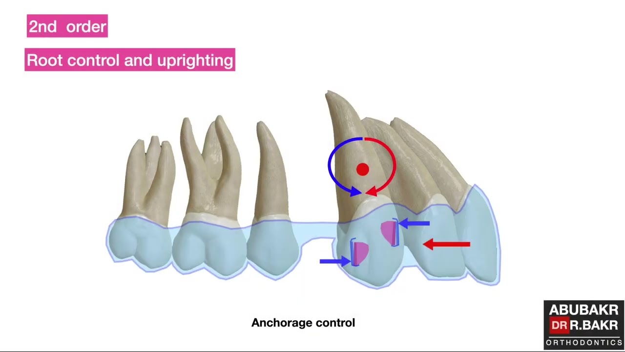 All you need to know about aligners & attachments biomechanics (part 2)