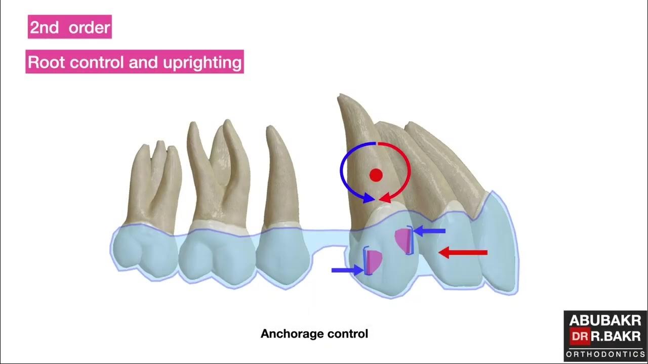 All you need to know about aligners & attachments biomechanics (part 2