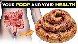 12 Things Your POOP Says About Your Health   Doctor Explains What Your Stool Is Telling You!