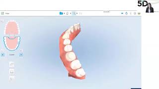 WEBINAR - iTero Digital restorative workflows at Shaw Lab Group