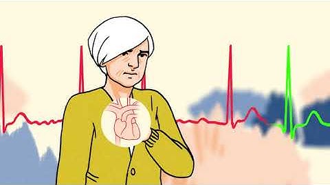 Effect of a Home Based Wearable ECG Patch Monitor on Detection of Undiagnosed Atrial Fibrillation in