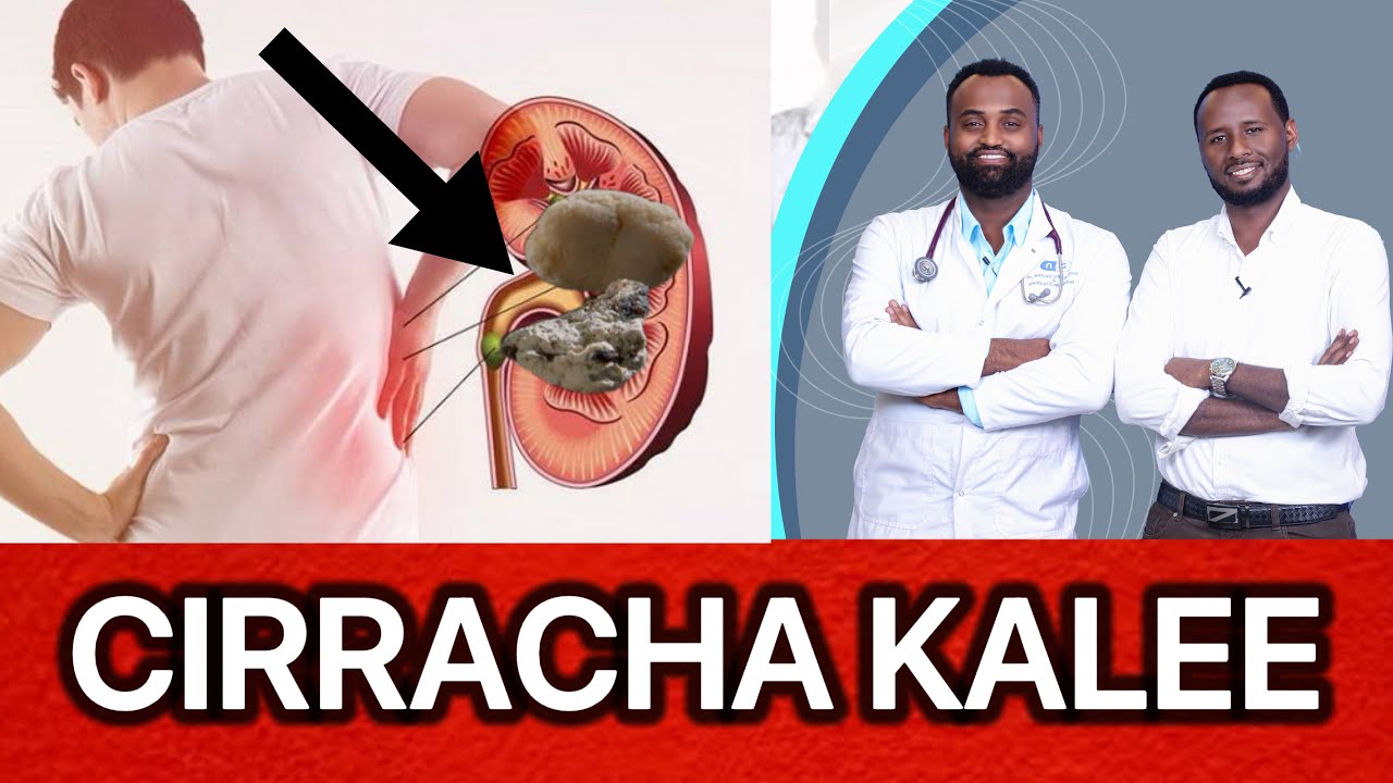 Of-eeggannoo 🛑 Cirrachi Kalee Kalee namaa Fail gochisiisuu danda’a! Furmaanni isaa maali
