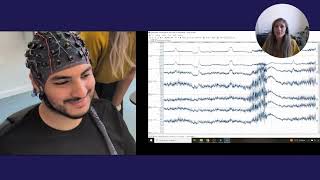 What are EEG Artifacts? - LabBench