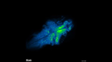 Whole-brain imaging of larval zebrafish