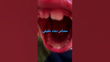مصاص دماء حقيقي Shorts 