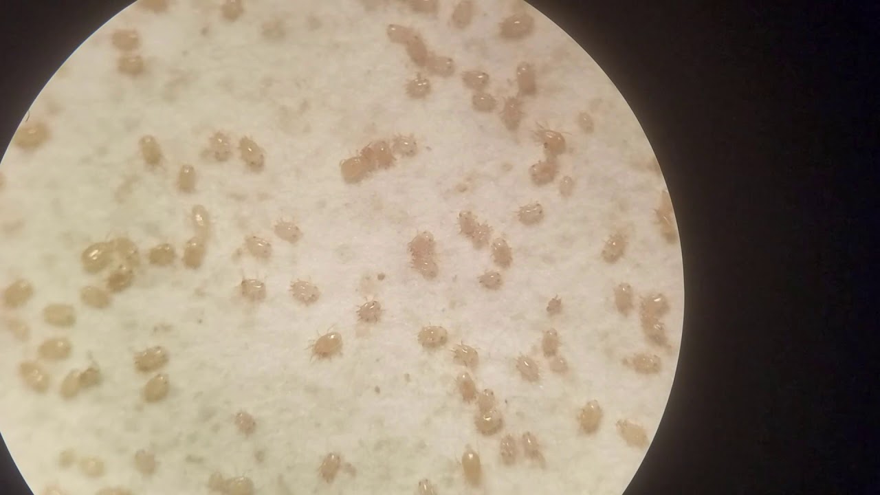 Three Soil Mites That Are No Threat