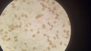 Famous Three Soil Mites That Are No Threat Profile