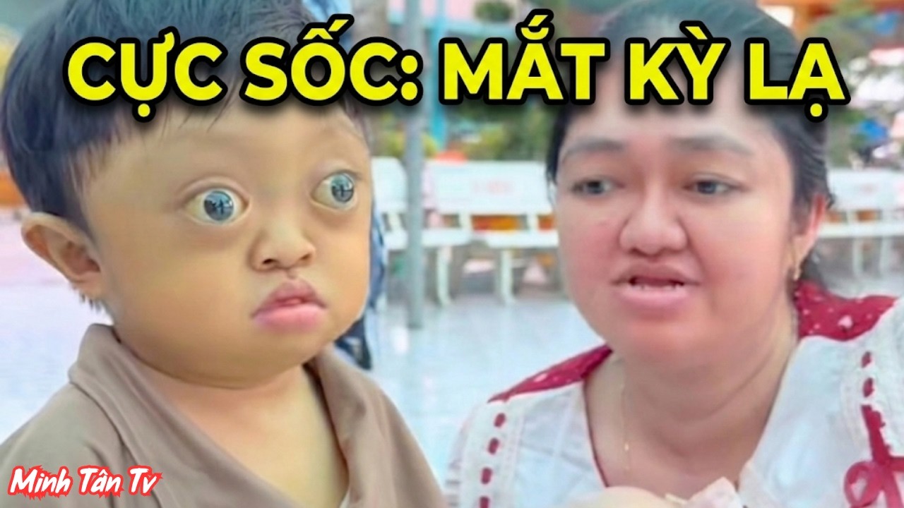Cực Sốc Xuất Hiện Cậu Bé Có Cặp Mắt Kỳ Lạ Gần 3 Tuổi - Minh Tân TV