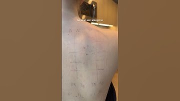 Patch Testing Part 4, the results