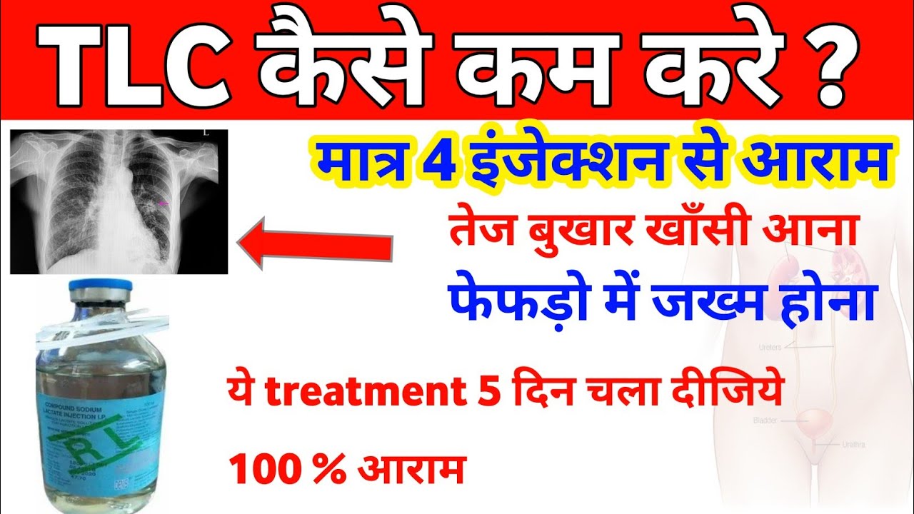 tlc kaise kam kare in hindi tlc kam karne ke upay tlc badhne se kya