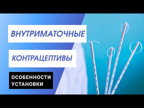 Введение внутриматочных контрацептивов- мастер класс