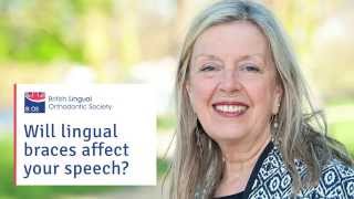 Will lingual braces affect my speech?