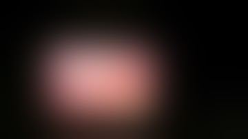 Full video of Laparoscopic appendectomy procedure with explanation #appendectomy #appendicitis