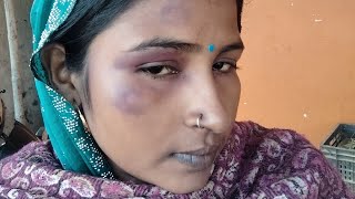 Please Aap Log Support Kariyega Bahut Se Jyada